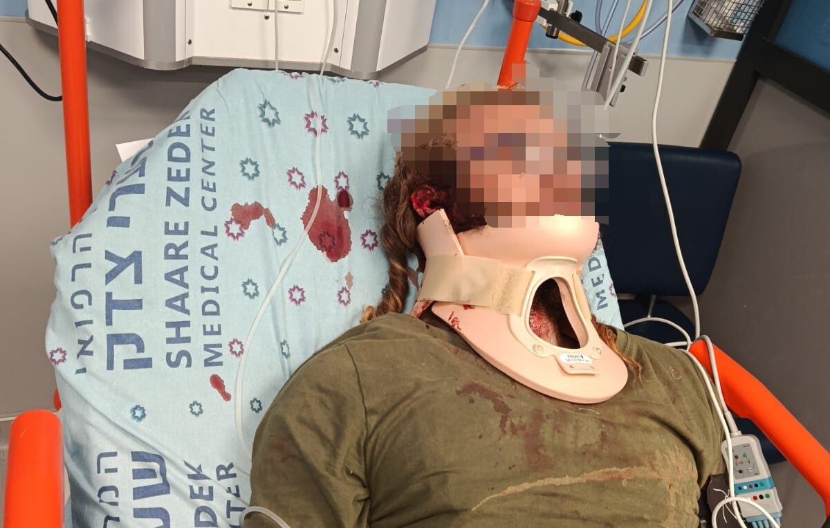 Arab Lynch Mob Wounds Jewish Shepherd, Two Teens