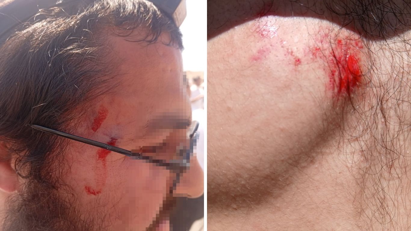 Arab Lynch Mob Attacks Jewish Hikers, Terrorist Eliminated